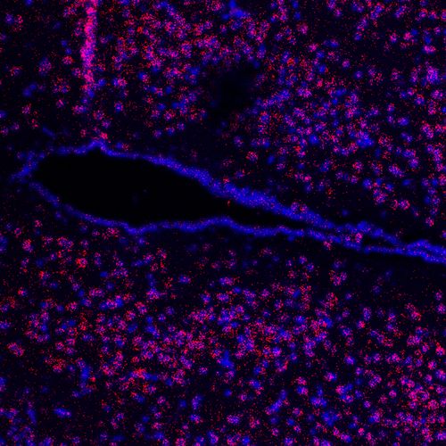 Mikroskopie eines Hypothalamus-Hirnschnitts. Zu sehen ist der dritte Ventrikel (schwarz). Die roten Punkte zeigen den Rezeptor und die Zellkerne sind blau eingefärbt.