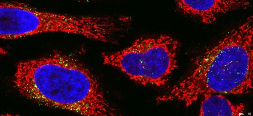 Mikroskop-Aufnahme von Hela-Zellen mit Zellkernen in blau, Zytosol in rot und antimikrobielles Peptid Api137 in grün