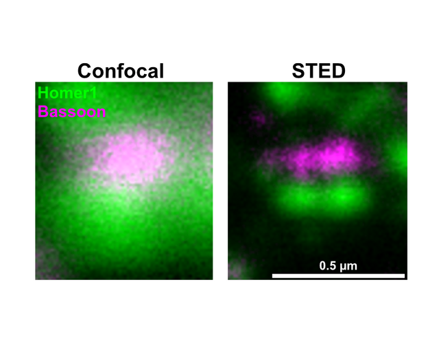 An image showing blurry pixelated clouds of green and magenta color on the left and much sharper defined borders between colors on the right.