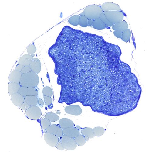 Mikroskopischer Querschnitt durch ein peripheres Nervenbündel (dunkelblau), welches hunderte von Schwann-Zellen ummantelte Nervenfasern enthält. In der Nachbarschaft des Nervs sind zahlreiche große Fettzellen (hellblau) zu sehen.