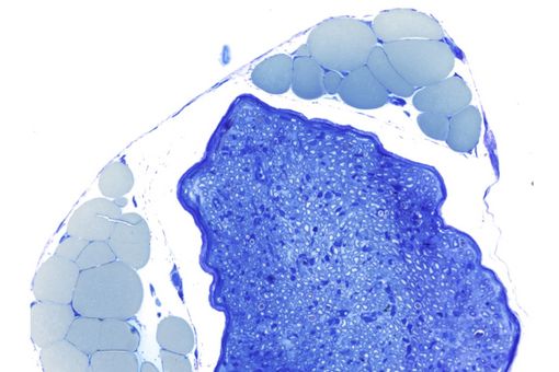 Microscopic cross-section through a peripheral nerve bundle (dark blue), which contains hundreds of nerve fibers coated with Schwann cells. Numerous large fat cells (light blue) can be seen in the vicinity of the nerve. Photo: Leipzig University