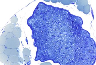 Mikroskopischer Querschnitt durch ein peripheres Nervenbündel (dunkelblau), welches hunderte von Schwann-Zellen ummantelte Nervenfasern enthält. In der Nachbarschaft des Nervs sind zahlreiche große Fettzellen (hellblau) zu sehen.