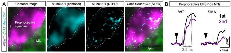 (A) A series of micrographs showing differentially stained synapses. (B) Two graphs with two lines depicting increases in synaptic potentials. Photo: AG Simon