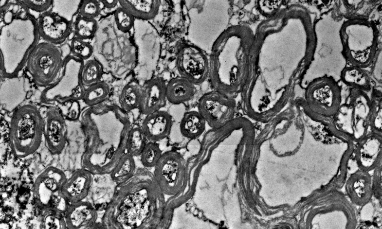 A black-and-white cross section of nervous tissue showing layered myelin sheets encompassing nerve fibers.