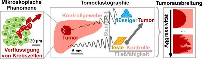 Tumor-assoziiert mikroskopische Effekte wie die Verflüssigung oder erhöhte Fließfähigkeit von Krebszellen haben Einfluss auf die makroskopischen mechanischen Eigenschaften des Tumors. Letztere lassen sich direkt im Körper mit Tomoelastographie messen.