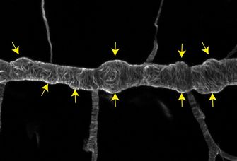 Lichtmikroskopische Aufnahme des Atemorgans eines Drosophila-Embryos. Die gelben Pfeile zeigen auf ungewöhnliche Ausbeulungen eines eigentlich glatten, röhrenförmigen Tracheenastes. Diese Ausbeulungen können nach kurzer Zeit einreißen und so die Funktion der Atemröhren zum Transport der Atemluft zerstören.