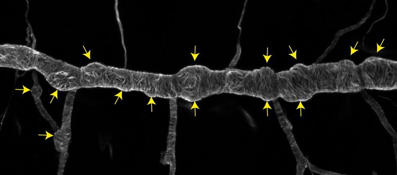 Lichtmikroskopische Aufnahme des Atemorgans eines Drosophila-Embryos. Die gelben Pfeile zeigen auf ungewöhnliche Ausbeulungen eines eigentlich glatten, röhrenförmigen Tracheenastes. Diese Ausbeulungen können nach kurzer Zeit einreißen und so die Funktion der Atemröhren zum Transport der Atemluft zerstören.