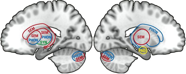 Schematic representation of the contribution of subcortical and cerebellar regions to the processing of language meaning (SEM), grammar (SYN) and phonetic properties of letters, syllables and words (PHON) and sentences (PROS). While many regions in the cerebellum and subcortex are involved in three subdomains (SEM, PHON, SYN), the amygdala alone is responsible for processing speech melody, rhythm and intonation (PROS). Credit: Turker and Hartwigsen, paper in Psychological Bulletin