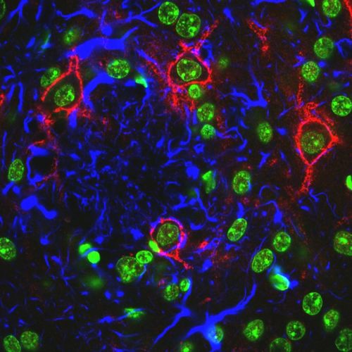 Blick durchs Laserscanning-Mikroskop: Grün sind die Zellkerne der Neuronen zu sehen, der rote Ring um einige Neuronen ist das perineuronale Netz. Die blauen Strukturen um die Bildmitte herum sind aktivierte Astrozyten, die die Amyloiden Plaques (Aß-Plaques) umschließen. In der freien Stelle in der Mitte ist der der amyloide Plaque aus Amyloid beta (Aß), das bei Alzheimer im Gehirn angehäuft wird.“