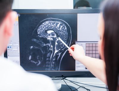 Two physicians examining an MRI scan displayed on the monitor