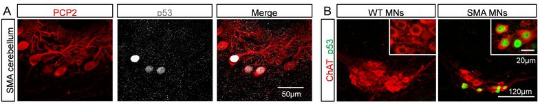 A series of micrographs showing red-labeled neurons on a black background