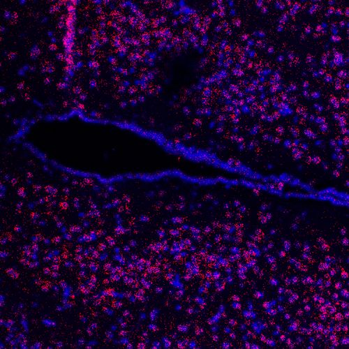 Mikroskopie eines Hypothalamus-Hirnschnitts. Zu sehen ist der dritte Ventrikel (schwarz). Die roten Punkte zeigen den Rezeptor und die Zellkerne sind blau eingefärbt.