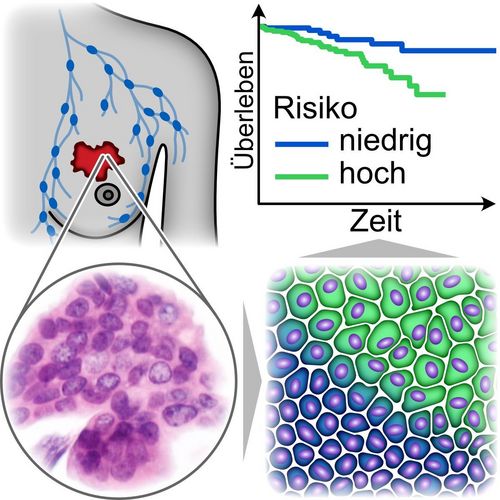 Zwei „Aggregatzustände“ von Krebszellclustern, blau: dicht gedrängte, eher rundliche Krebszellen klemmen sich gegenseitig ein und können sich nicht bewegen („Jamming“). Grün: länglichere, lockerer gepackte Krebszellen können sich aneinander vorbeidrängen und somit andere Gewebe befallen. Diese Zellparameter prognostizieren eine bessere (blau) oder. schlechtere (grün) Überlebenswahrscheinlichkeit.