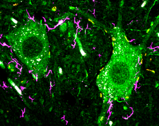 A section of mouse nervous tissue shows green-labelled motor neurons surrounded by magenta-coloured microglia.