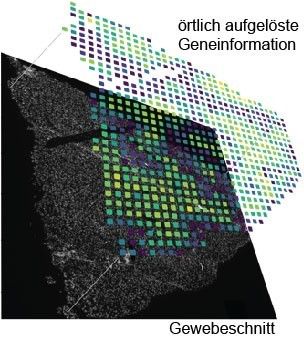 Beispielbild für die ortsaufgelöste Analyse eines Gens auf einem Nierengewebeschnitt