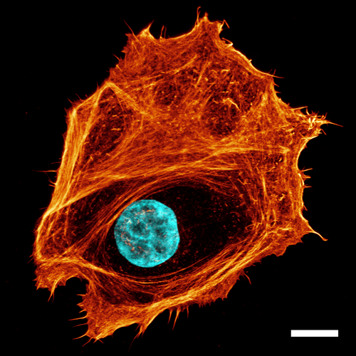 Das Zytoskelett durchzieht Zellen (gezeigt sind hier Aktinstrukturen in Orange und der Zellkern in Türkis) und gibt ihnen mechanische Stabilität. Diese Strukturen zeigen deutliche Variationen bei krebsartigen Veränderungen und beeinflussen damit maßgeblich die Zellmechanik.