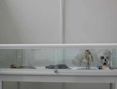 In einer Vitrine liegen Ausstellungsstücke der Pathologie, unter anderem ein menschlicher Schädel.