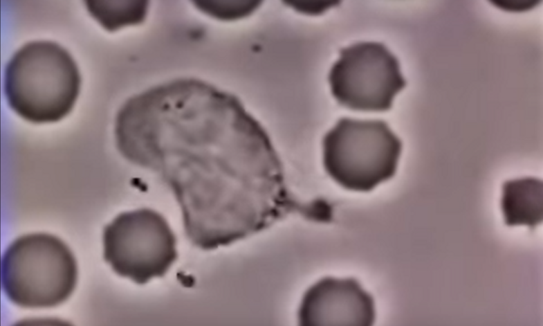 Farbfoto: Mikroskopaufnahme von weißen Blutkörperchen und einer Bakterie. Die Bakterie ist größer und asymmetrisch. Die weißen Blutzellen sind fast kreisrund und umlagern die Bakterie.
