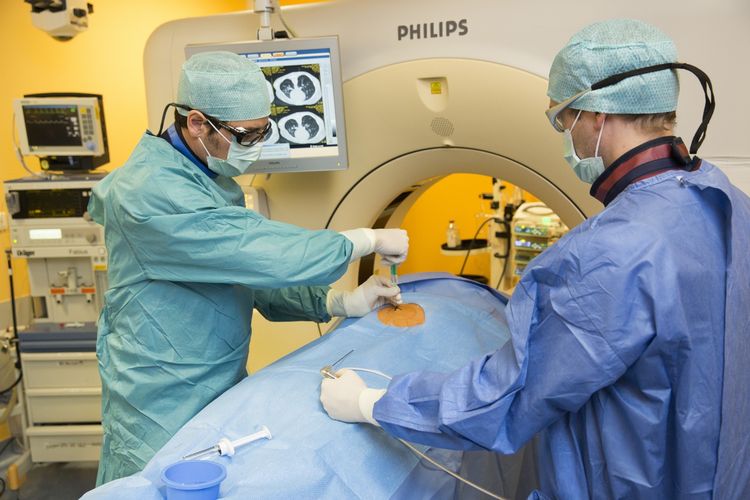 Oberarzt Dr. Michael Moche (li) und Jochen Fuchs platzieren eine Mikrowellensonde mit Hilfe der Bildgebung eines Computertomographen präzise in den Tumor eines Patienten.