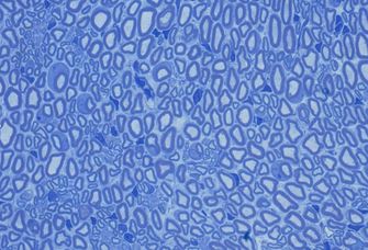Der Querschnitt durch einen Nerv zeigt von Schwannzellen ummantelte Nervenfasern (blaue Ringe) und zahlreiche Zellkerne (dunkelblau)