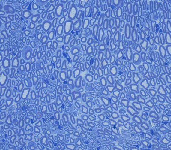 Der Querschnitt durch einen Nerv zeigt von Schwannzellen ummantelte Nervenfasern (blaue Ringe) und zahlreiche Zellkerne (dunkelblau)