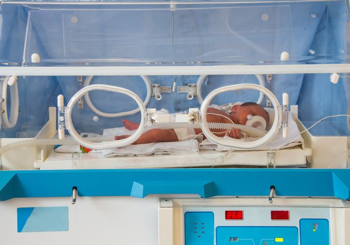 Babies with congenital diaphragmatic herniaare placed on a ventilator immediately after birth. Photo: Colourbox