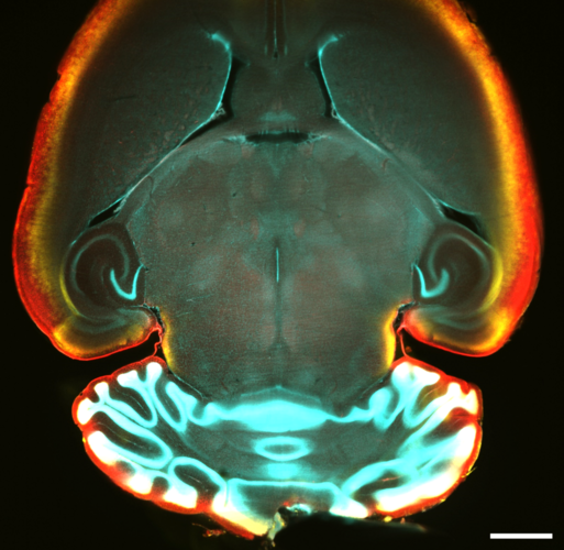 A horizontal section of the whole mouse brain with immunostainings of cell bodies (red), cell nuclei (cyan), and myelinated fibers (yellow).